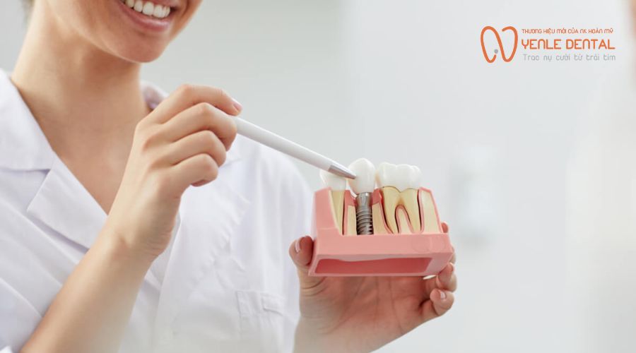 chăm sóc sau 24 giờ trồng răng implant